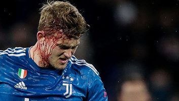 Lyon 1 – 0 Juventus | Xem lại trận đấu